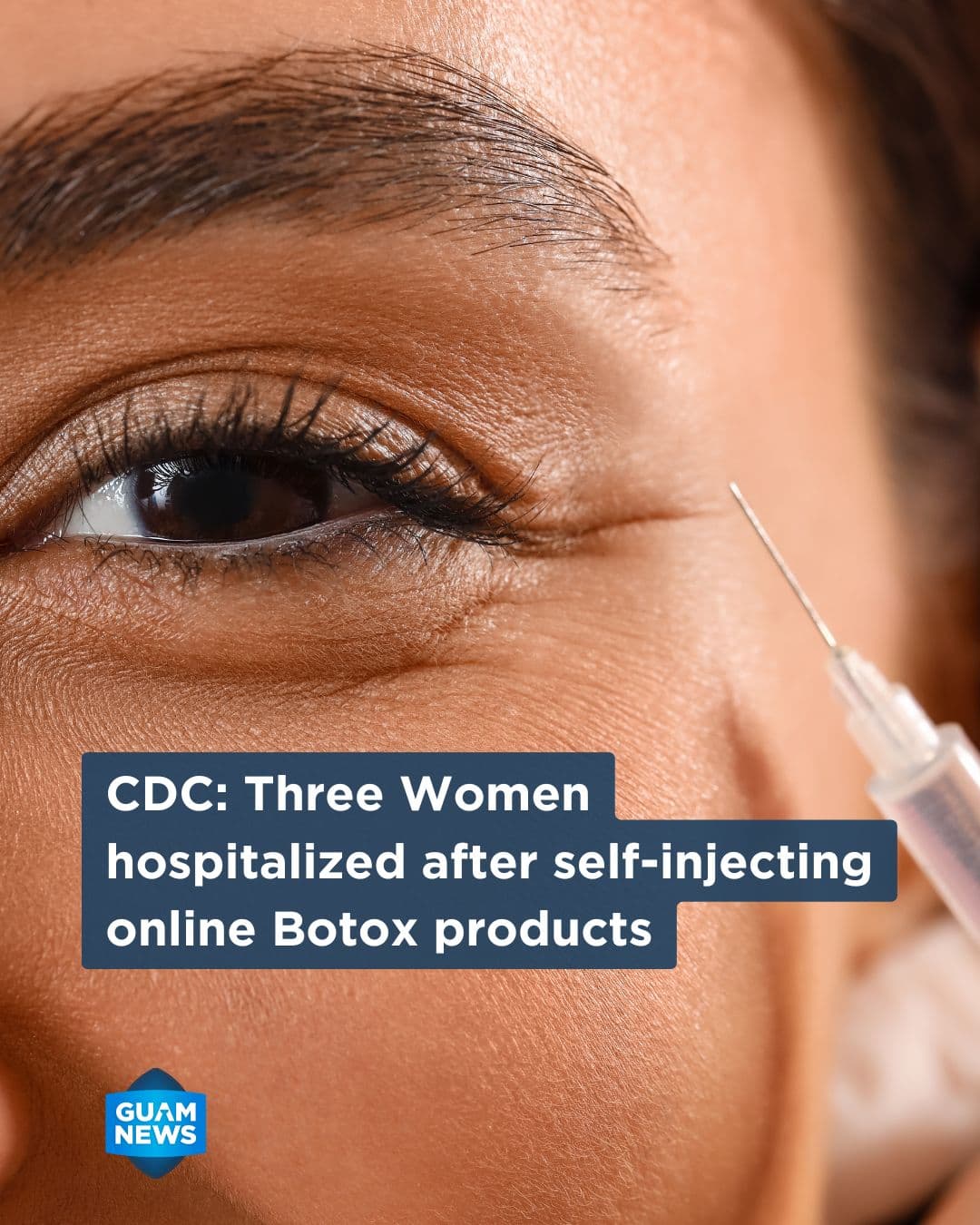 CDC warns after DIY botox injections hospitalize three