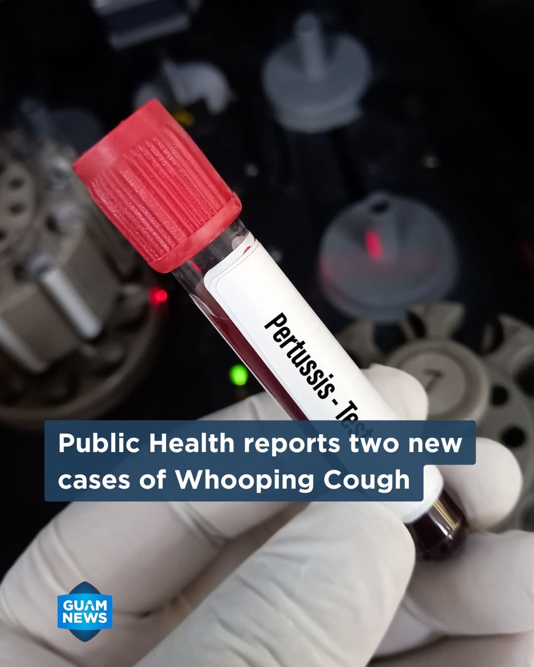 Two more whooping cough cases bring 2025 total to seven
