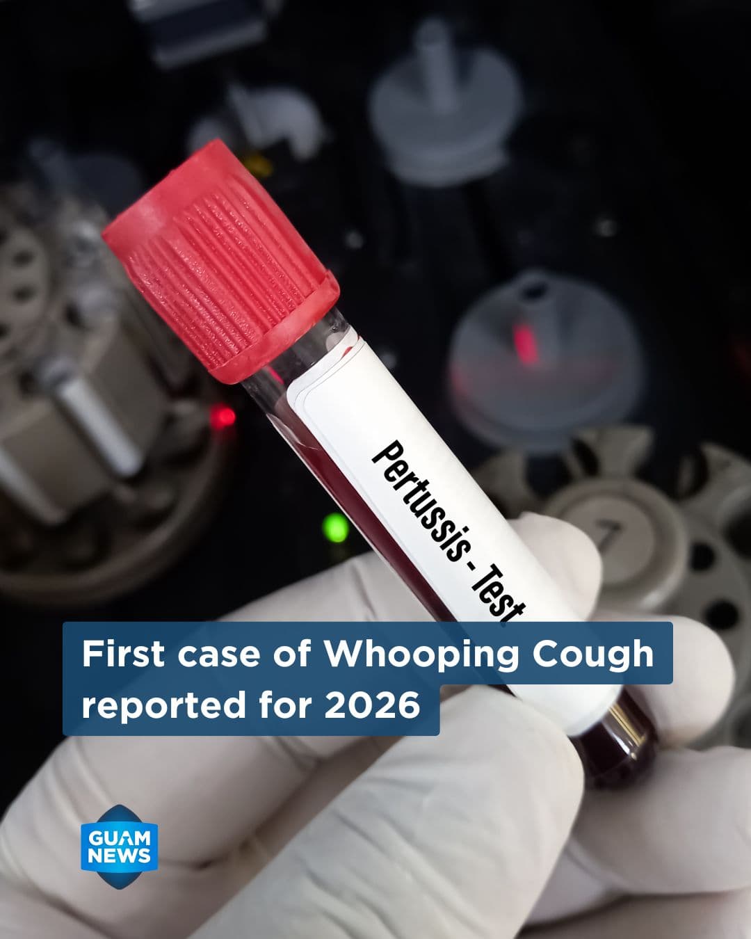 Guam confirms first whooping cough case of 2026