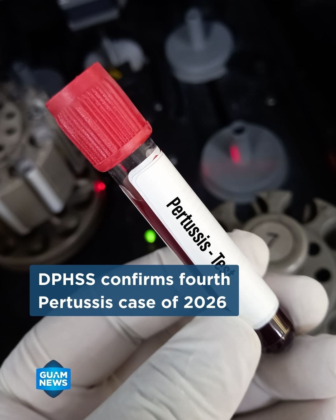 Public Health confirms another whooping cough case
