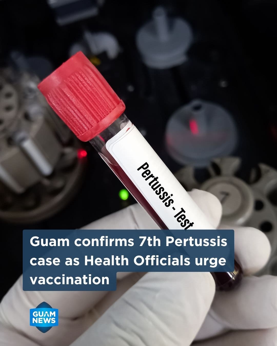 Whooping cough count on Guam climbs to seven for 2026