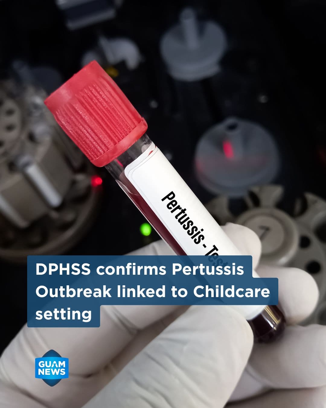 Public Health confirms pertussis outbreak on Guam
