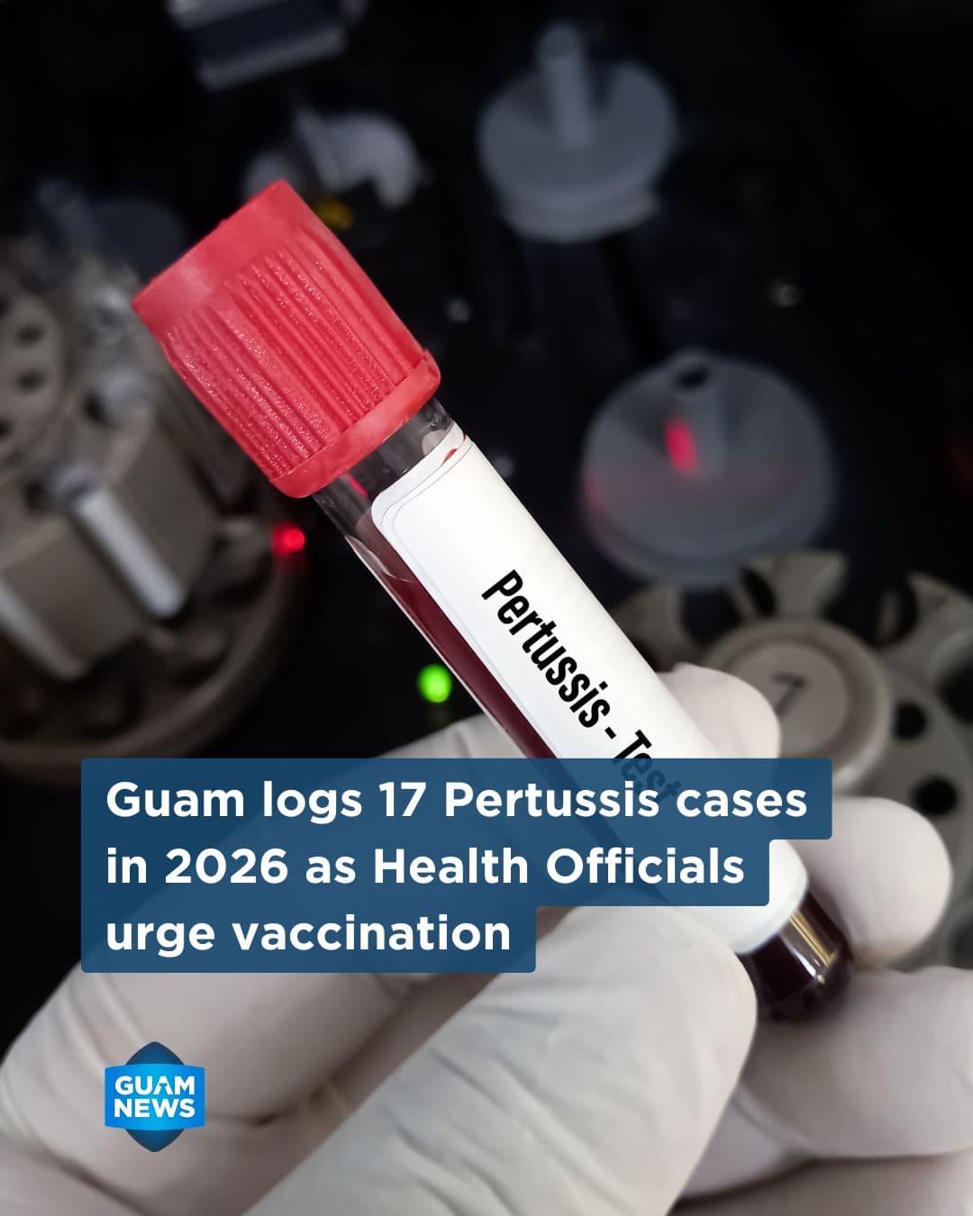 Guam records 17 whooping cough cases so far this year